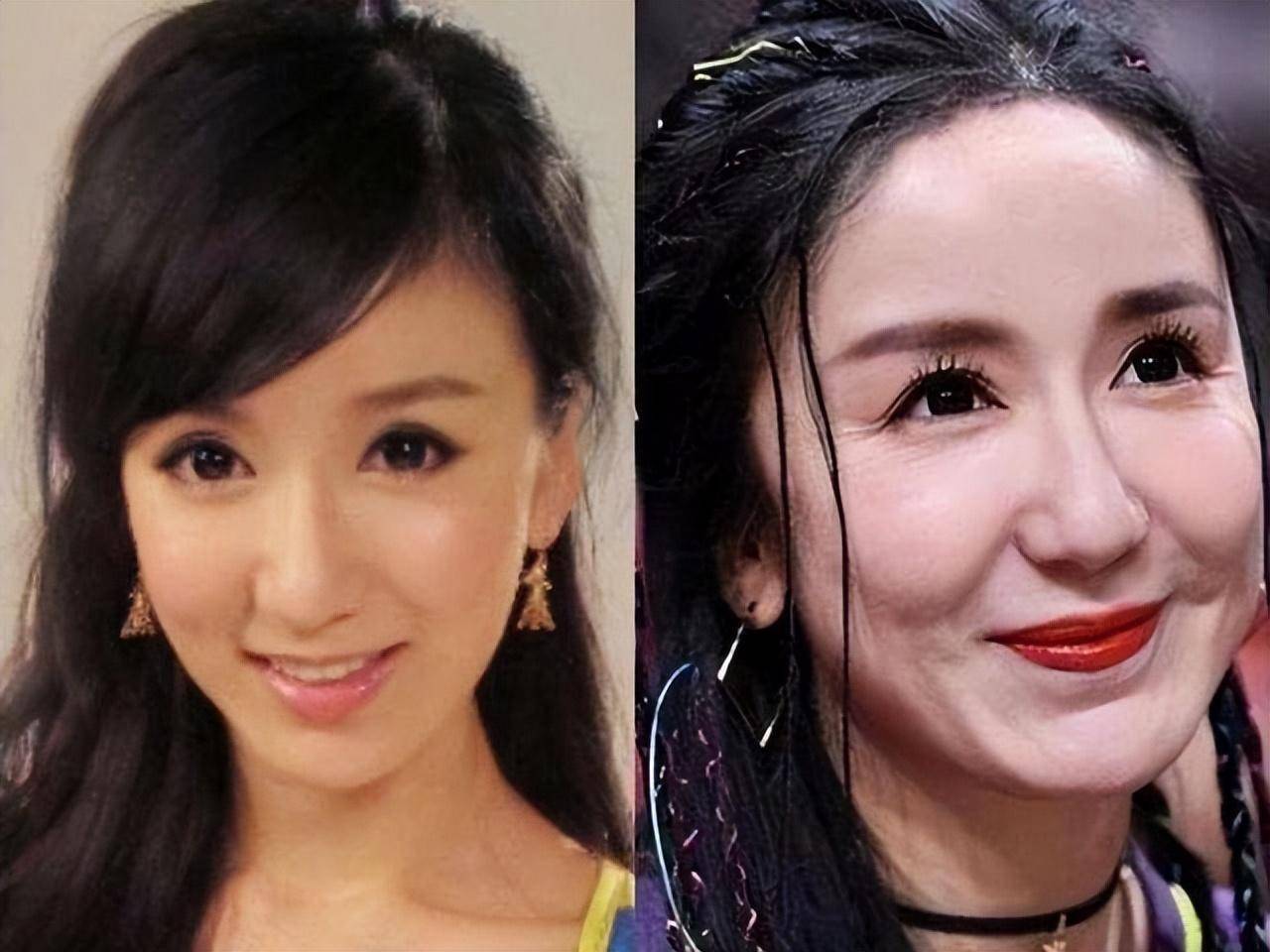 被整容耽误的女明星_娱乐圈没整过容的明星_赵樱子整容前后对比